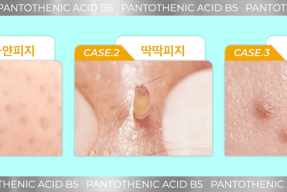 [수딩진정] 넘버즈인 1번 판토텐산 액티브 수딩크림 80ml 기획 (+패드 6매) 상세페이지 7